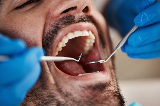 Best Mobile Emergency Dentist in Donna, TX