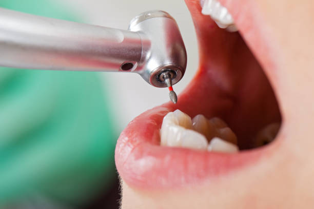 Best Pediatric Emergency Dentist in Donna, TX